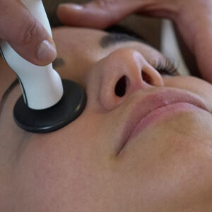 Diatermia facial